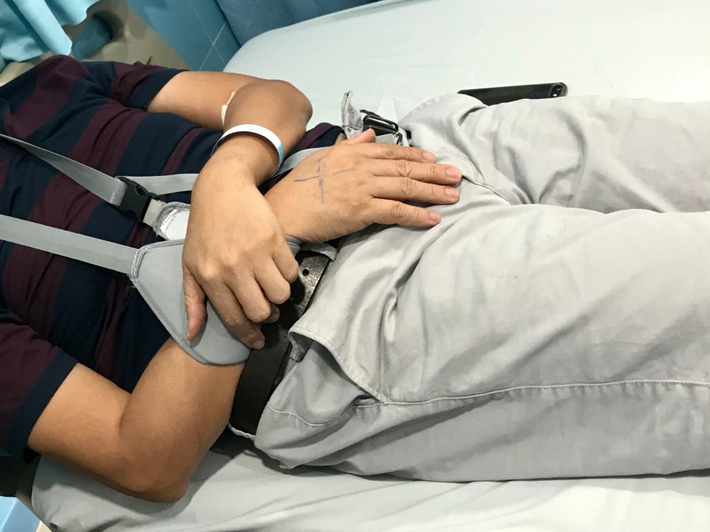 Ký sự chấn thương: Trật khớp cùng&nbsp;đòn